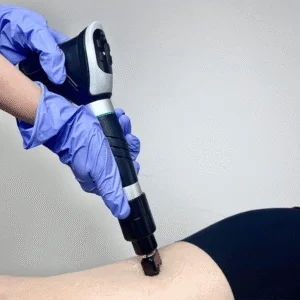 Pneumatic Radial Shockwave Therapy Device AV-30